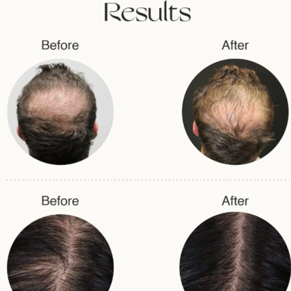 Advanced Hair Growth Serum Nourish Mantra - Picture 4 of 4